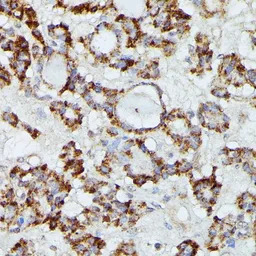 Anti-MANBA antibody used in IHC (Paraffin sections) (IHC-P). GTX66354