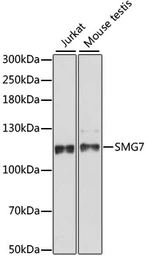 Anti-SMG7 antibody used in Western Blot (WB). GTX66369