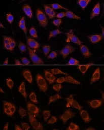 Anti-GFPT2 antibody used in Immunocytochemistry/ Immunofluorescence (ICC/IF). GTX66370