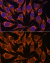 Anti-SEMA3C antibody used in Immunocytochemistry/ Immunofluorescence (ICC/IF). GTX66372