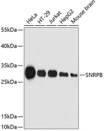 Anti-SNRPB antibody used in Western Blot (WB). GTX66411