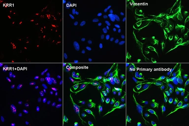 Anti-KRR1 antibody used in Immunocytochemistry/ Immunofluorescence (ICC/IF). GTX66443
