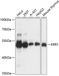 Anti-KRR1 antibody used in Western Blot (WB). GTX66443