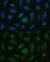 Anti-SIGLEC9 antibody used in Immunocytochemistry/ Immunofluorescence (ICC/IF). GTX66449