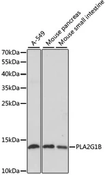 Anti-PLA2G1B antibody used in Western Blot (WB). GTX66466