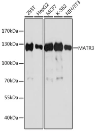 Anti-MATR3 antibody used in Western Blot (WB). GTX66470