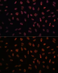Anti-MATR3 antibody used in Immunocytochemistry/ Immunofluorescence (ICC/IF). GTX66470