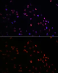 Anti-MATR3 antibody used in Immunocytochemistry/ Immunofluorescence (ICC/IF). GTX66470