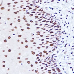 Anti-MATR3 antibody used in IHC (Paraffin sections) (IHC-P). GTX66470