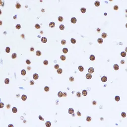 Anti-MATR3 antibody used in IHC (Paraffin sections) (IHC-P). GTX66470