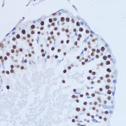 Anti-MATR3 antibody used in IHC (Paraffin sections) (IHC-P). GTX66470
