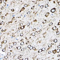 Anti-RPL17 antibody used in IHC (Paraffin sections) (IHC-P). GTX66472