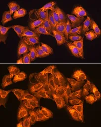 Anti-ZCCHC11 antibody used in Immunocytochemistry/ Immunofluorescence (ICC/IF). GTX66474