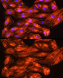 Anti-ZCCHC11 antibody used in Immunocytochemistry/ Immunofluorescence (ICC/IF). GTX66474
