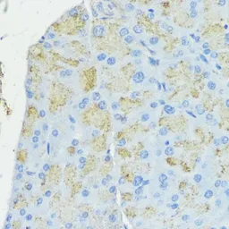 Anti-SOD3 antibody used in IHC (Paraffin sections) (IHC-P). GTX66490