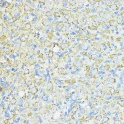 Anti-SOD3 antibody used in IHC (Paraffin sections) (IHC-P). GTX66490
