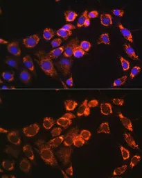 Anti-TRIM23 antibody used in Immunocytochemistry/ Immunofluorescence (ICC/IF). GTX66516