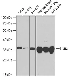 Anti-GNB2 antibody used in Western Blot (WB). GTX66519