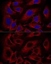 Anti-ARL8B antibody used in Immunocytochemistry/ Immunofluorescence (ICC/IF). GTX66546
