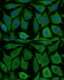 Anti-SARDH antibody used in Immunocytochemistry/ Immunofluorescence (ICC/IF). GTX66575