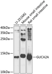 Anti-Guanylin antibody used in Western Blot (WB). GTX66582