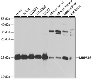 Anti-MRPS16 antibody used in Western Blot (WB). GTX66585