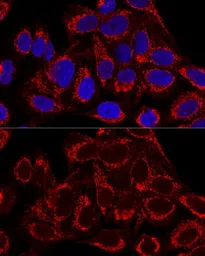 Anti-MRPS16 antibody used in Immunocytochemistry/ Immunofluorescence (ICC/IF). GTX66585