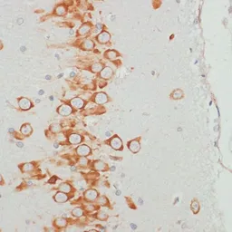 Anti-VASP (phospho Ser157) antibody used in IHC (Paraffin sections) (IHC-P). GTX66601