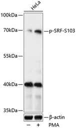 Anti-SRF (phospho Ser103) antibody used in Western Blot (WB). GTX66603