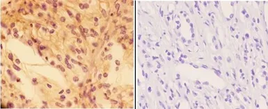 Anti-PTPRO antibody used in IHC (Paraffin sections) (IHC-P). GTX66615