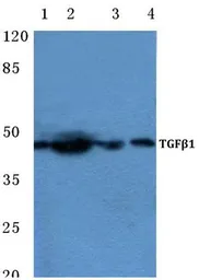 Anti-TGF beta 1 antibody used in Western Blot (WB). GTX66628