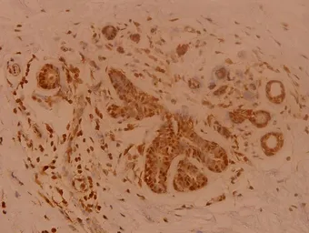 Anti-SENP1 antibody used in IHC (Paraffin sections) (IHC-P). GTX66632