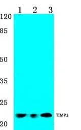 Anti-TIMP1 antibody used in Western Blot (WB). GTX66643