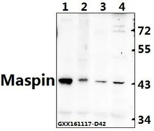 Anti-MASPIN antibody used in Western Blot (WB). GTX66666