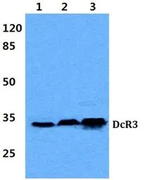 Anti-DcR3 antibody used in Western Blot (WB). GTX66684