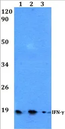 Anti-Interferon gamma antibody used in Western Blot (WB). GTX66714