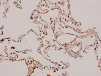 Anti-PDGFA antibody used in IHC (Paraffin sections) (IHC-P). GTX66716