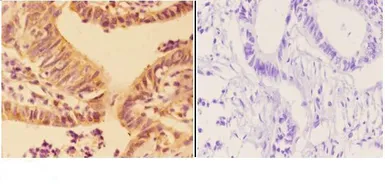 Anti-APOBEC3C antibody used in IHC (Paraffin sections) (IHC-P). GTX66774