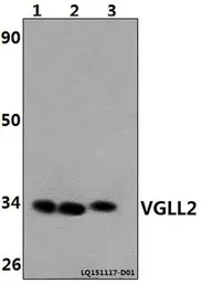 Anti-VGLL2 antibody used in Western Blot (WB). GTX66803