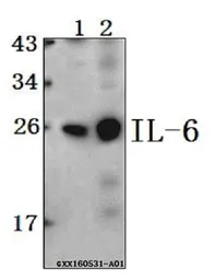 Anti-IL6 antibody used in Western Blot (WB). GTX66828