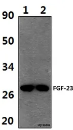 Anti-FGF23 antibody used in Western Blot (WB). GTX66836