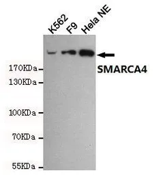 Anti-BRG1 antibody [6D7] used in Western Blot (WB). GTX66842