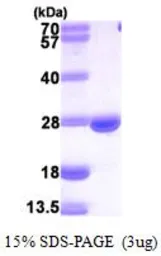 mouse DHFR protein, His tag (active). GTX66970-pro