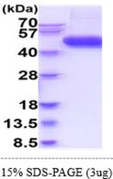 Human IL1 Receptor 2 protein, His tag (active). GTX67059-pro