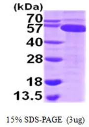 Human TrxR1 protein, His tag (active). GTX67176-pro