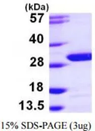 Human UCHL3 protein, His tag (active). GTX67178-pro
