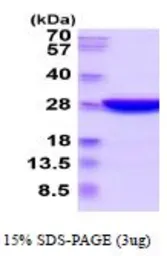 Mouse UCHL3 protein, His tag (active). GTX67179-pro