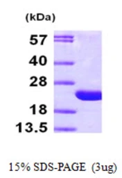 Human ARF6 protein, His tag. GTX67233-pro
