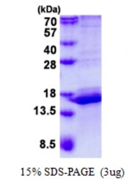 Human CALML3 protein, His tag. GTX67263-pro