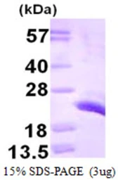 Human Centrin 1 protein, His tag. GTX67291-pro